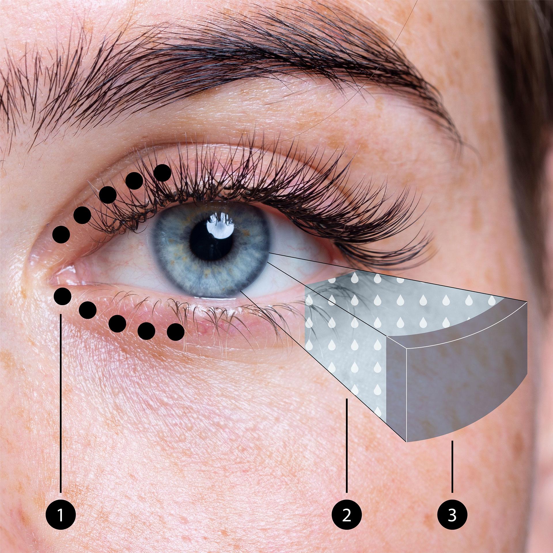 Imagem de um olho, que mostra a posição das glândulas meibomianas nas pálpebras e a camada de meibum sobre o fluido lacrimal do olho.